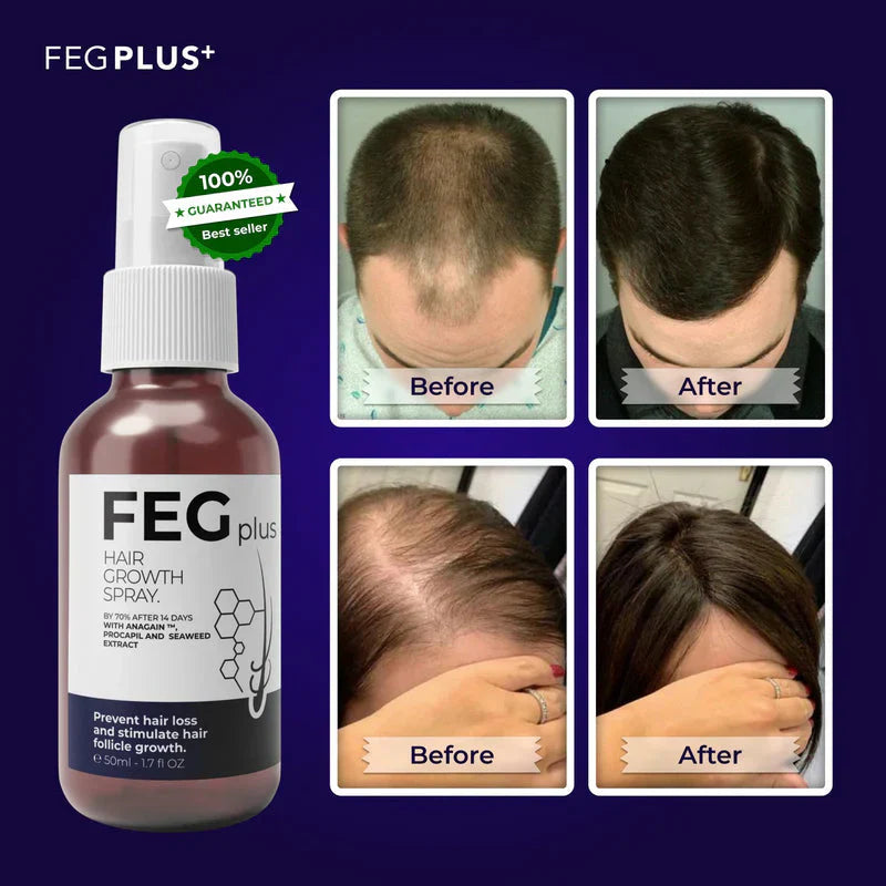 Premium FEG Plus Hair Growth 100% Fast + Organic Solution