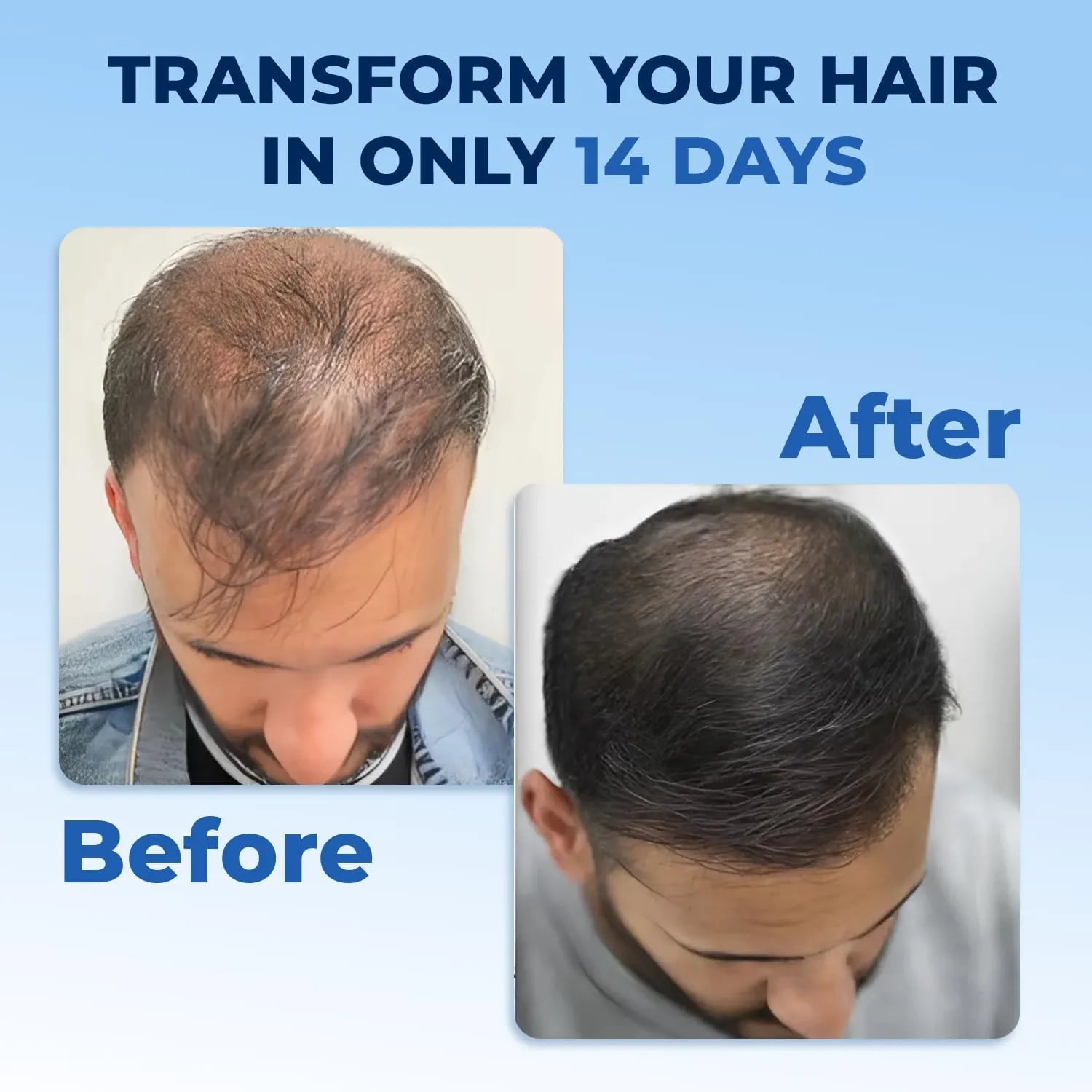 Premium FEG Plus Hair Growth 100% Fast + Organic Solution