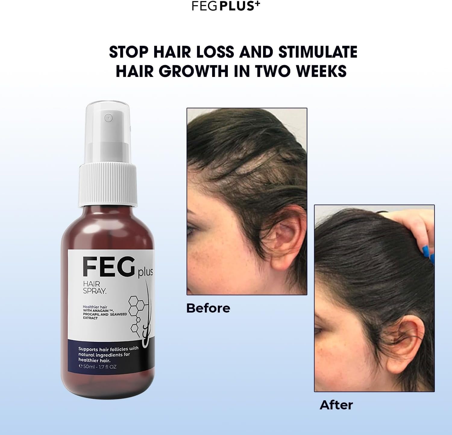 Premium FEG Plus Hair Growth 100% Fast + Organic Solution